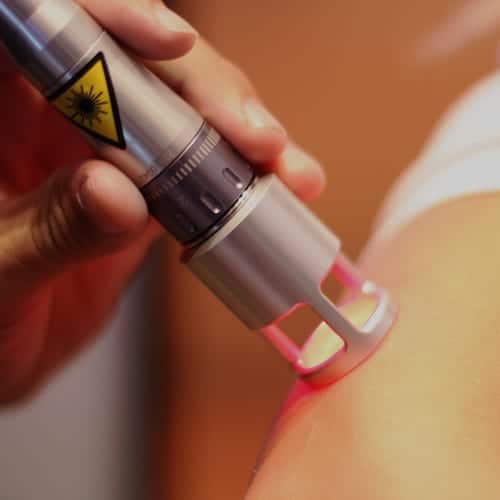 Mississauga Laser Therapy Clinic