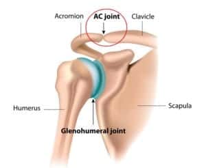 Acromioclavicular Sprain