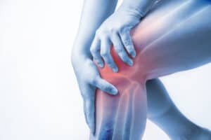 Patellofemoral Syndrome causing knee pain being treated by our Mississauga Chiropractor and Physiotherapist
