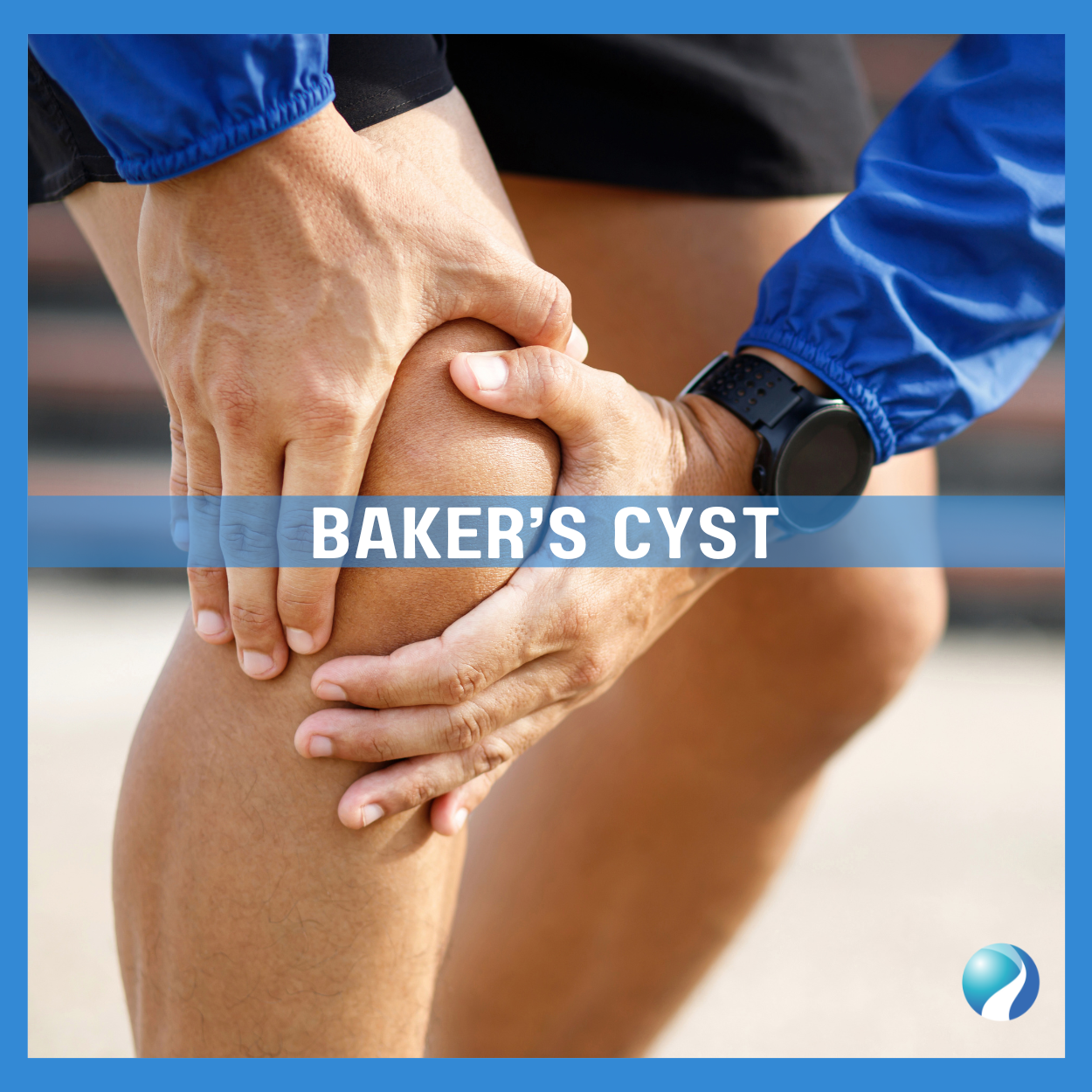 How To Manage A Baker's Cyst Mississauga and Oakville Chiropractor and Physiotherapy Clinic
